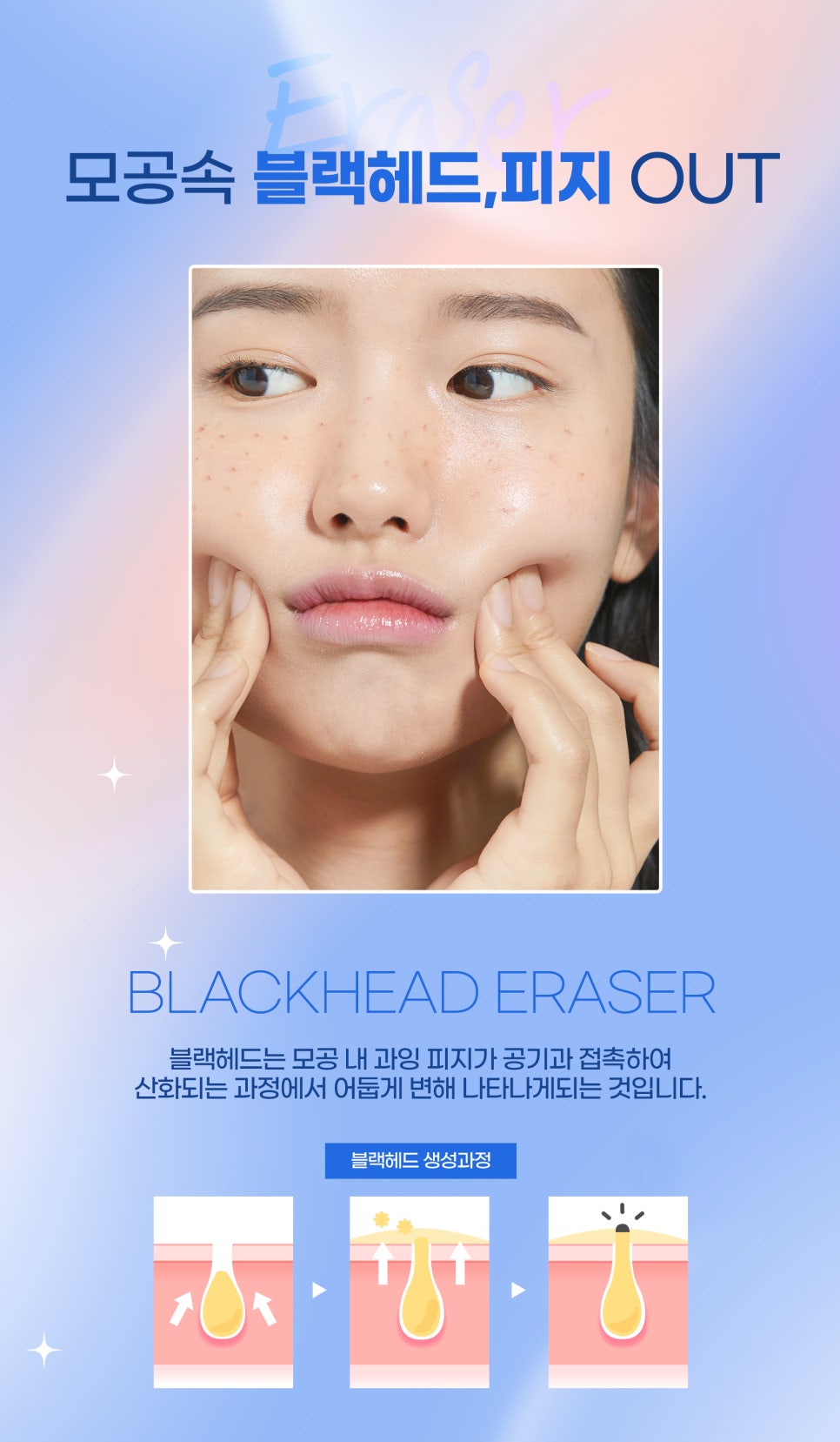 블랙헤드관리, 모공 속 피지 관리가 우선 관련 이미지 2