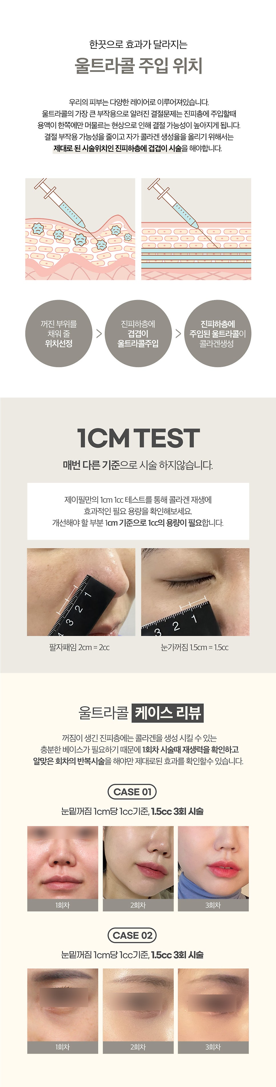 홍대울트라콜, 빈틈없는 콜라겐 필러 관련 이미지 4