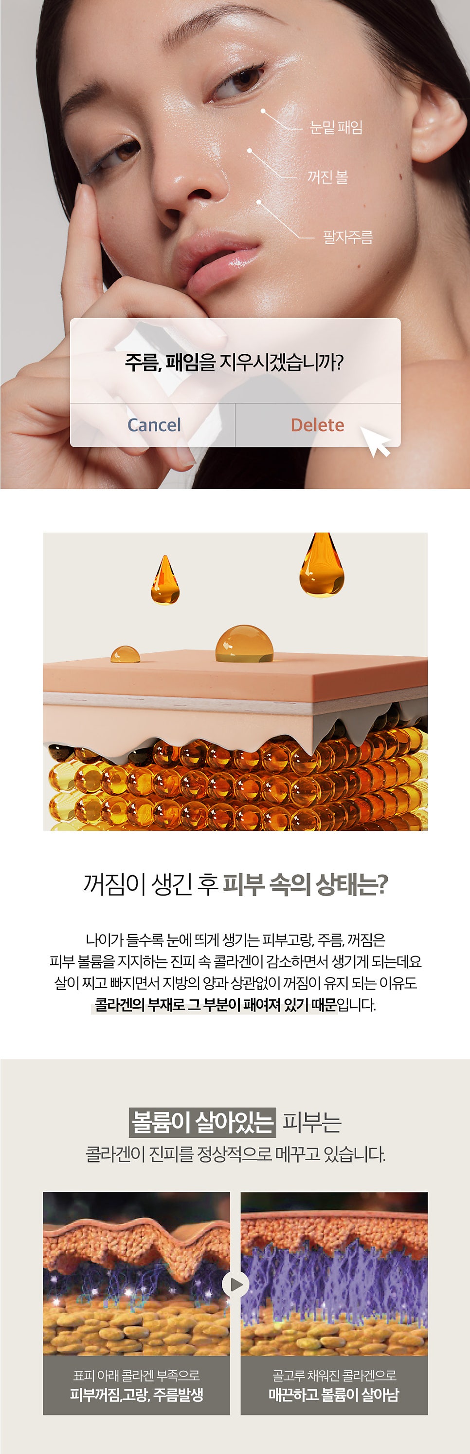 홍대울트라콜, 빈틈없는 콜라겐 필러 관련 이미지 2
