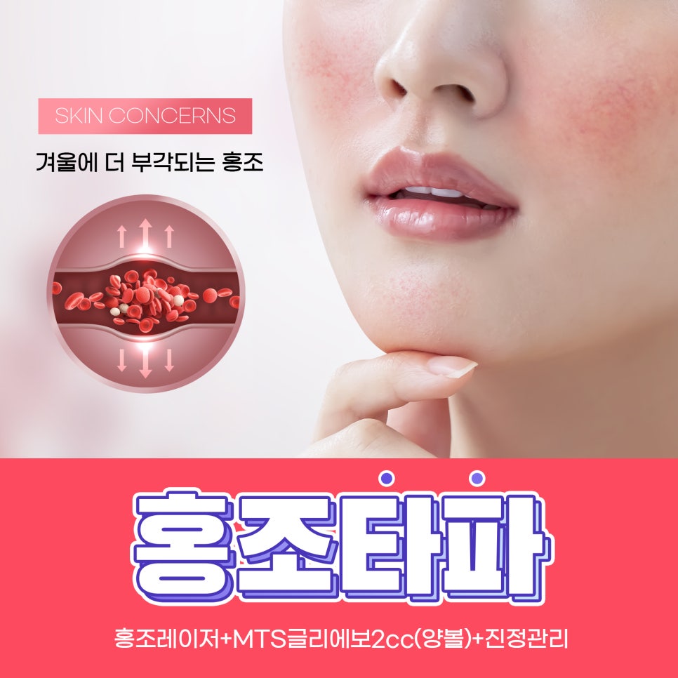 안면홍조 개선하고 싶다면? 관련 이미지 1