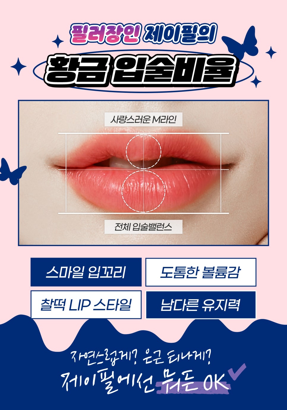 입술 전용 필러 레스틸렌키스로 도톰하고 볼륨감 있는 입술 만들기 관련 이미지 4