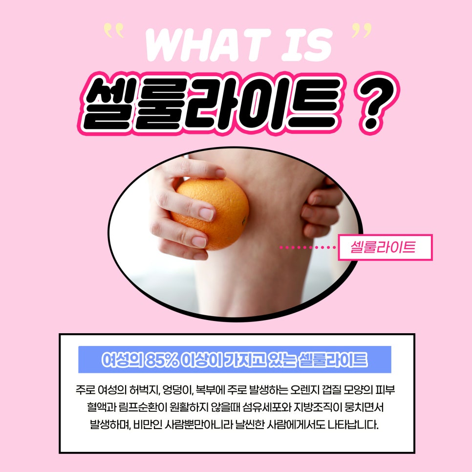허벅지 셀룰라이트 분해, 제거하는 유일한 방법 관련 이미지 2