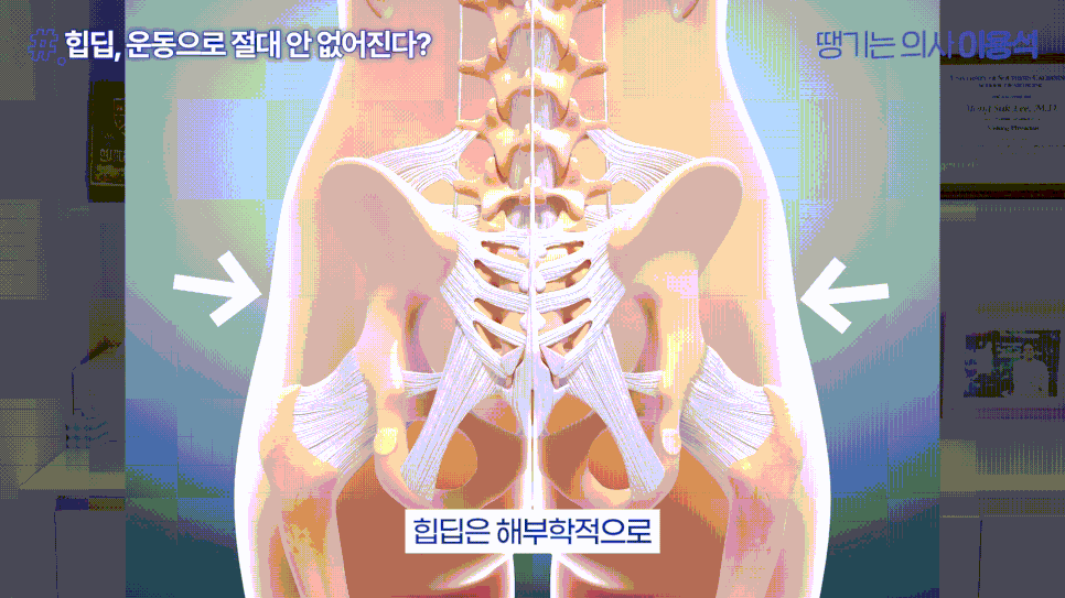 힙필러 전 꼭 알아야 할 사실|힙딥은 단순히 볼륨보다 구조가 중요합니다 관련 이미지 5