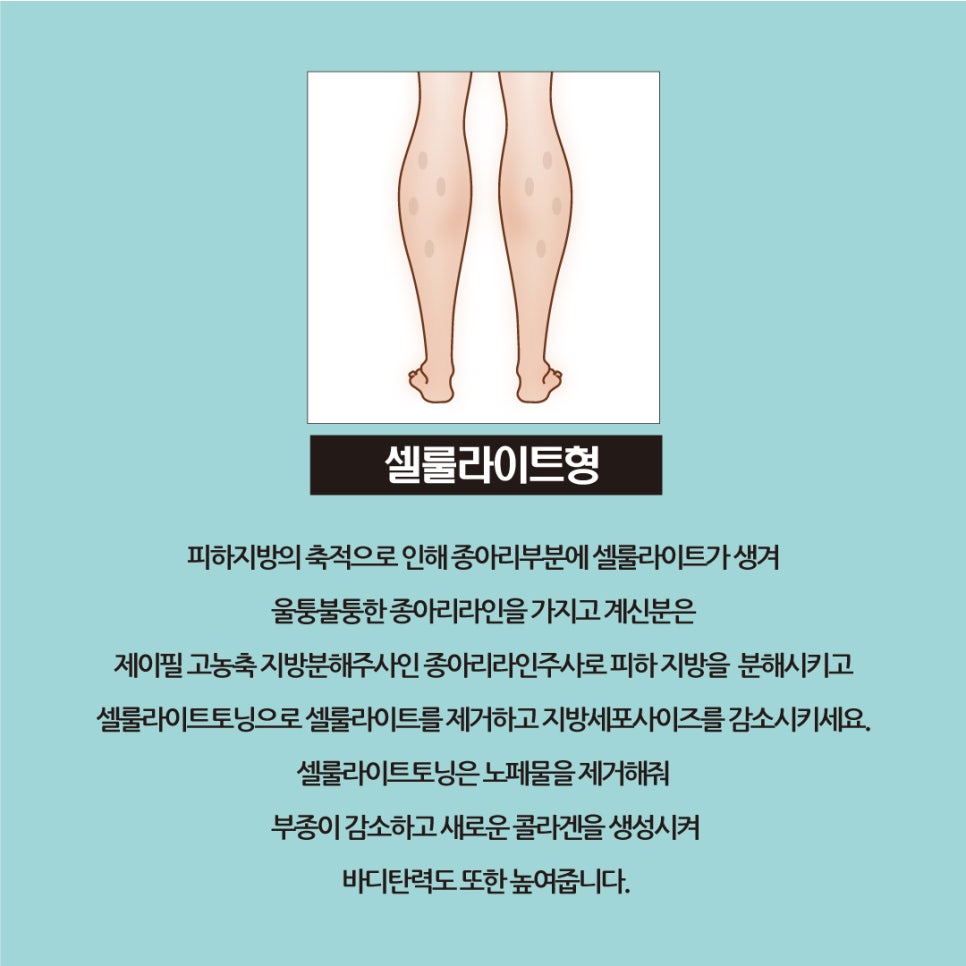 매끈한 종아리는  홍대 제이필 보톡스와 셀룰라이트 토닝 콜라보로 관련 이미지 3