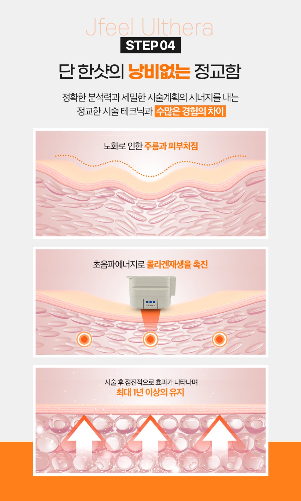인스티튜터의 맞춤울쎄라로 리프팅효과 확실히보세요 관련 이미지 6