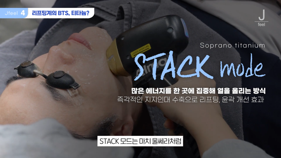 연예인리프팅, 티타늄리프팅으로 갈아탄 이유와 Q&A 관련 이미지 5