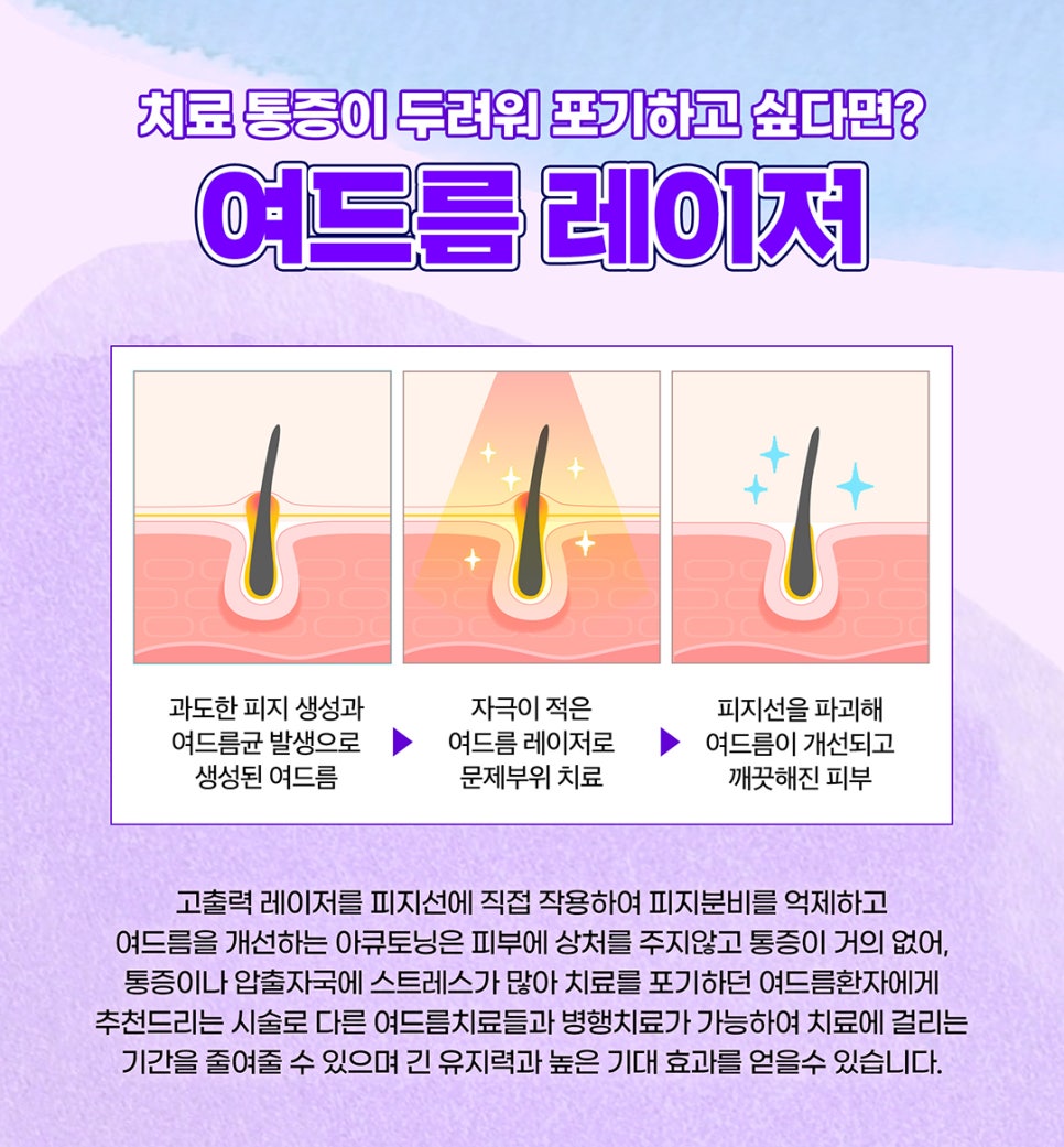 피지억제 레이저로 기름진 얼굴 여드름 STOP 관련 이미지 5