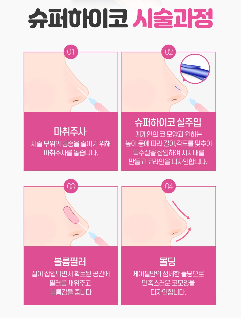 슈퍼하이코 만족도 높은 코 필러 알아본다면 제이필클리닉 관련 이미지 8