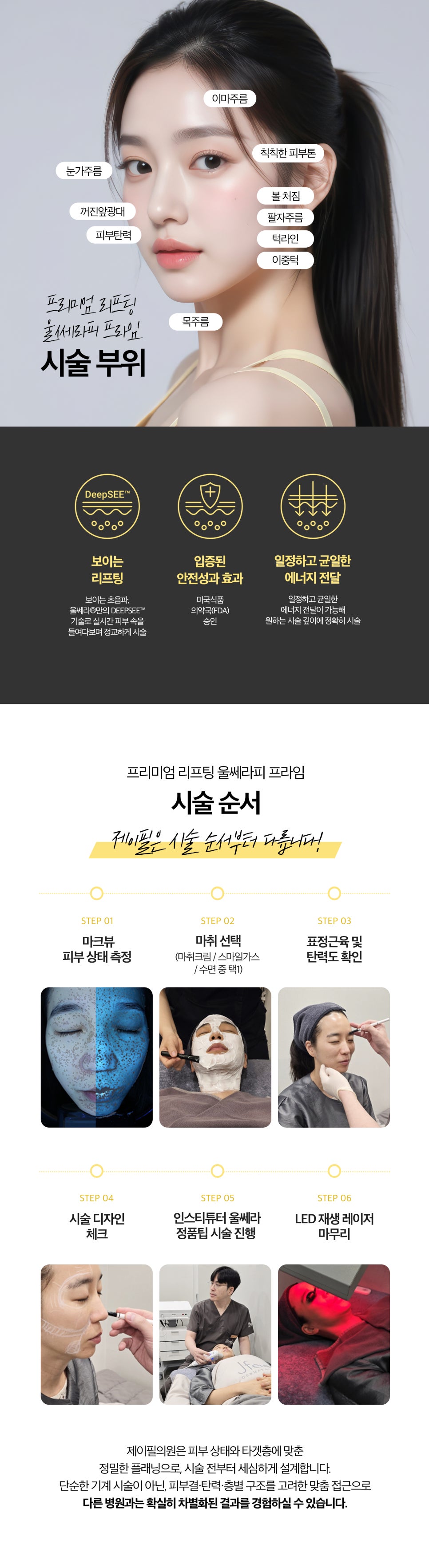 강남 울쎄라피 프라임, 울쎄라 300샷이면 누구에게나 효과가 좋을가요? 관련 이미지 6