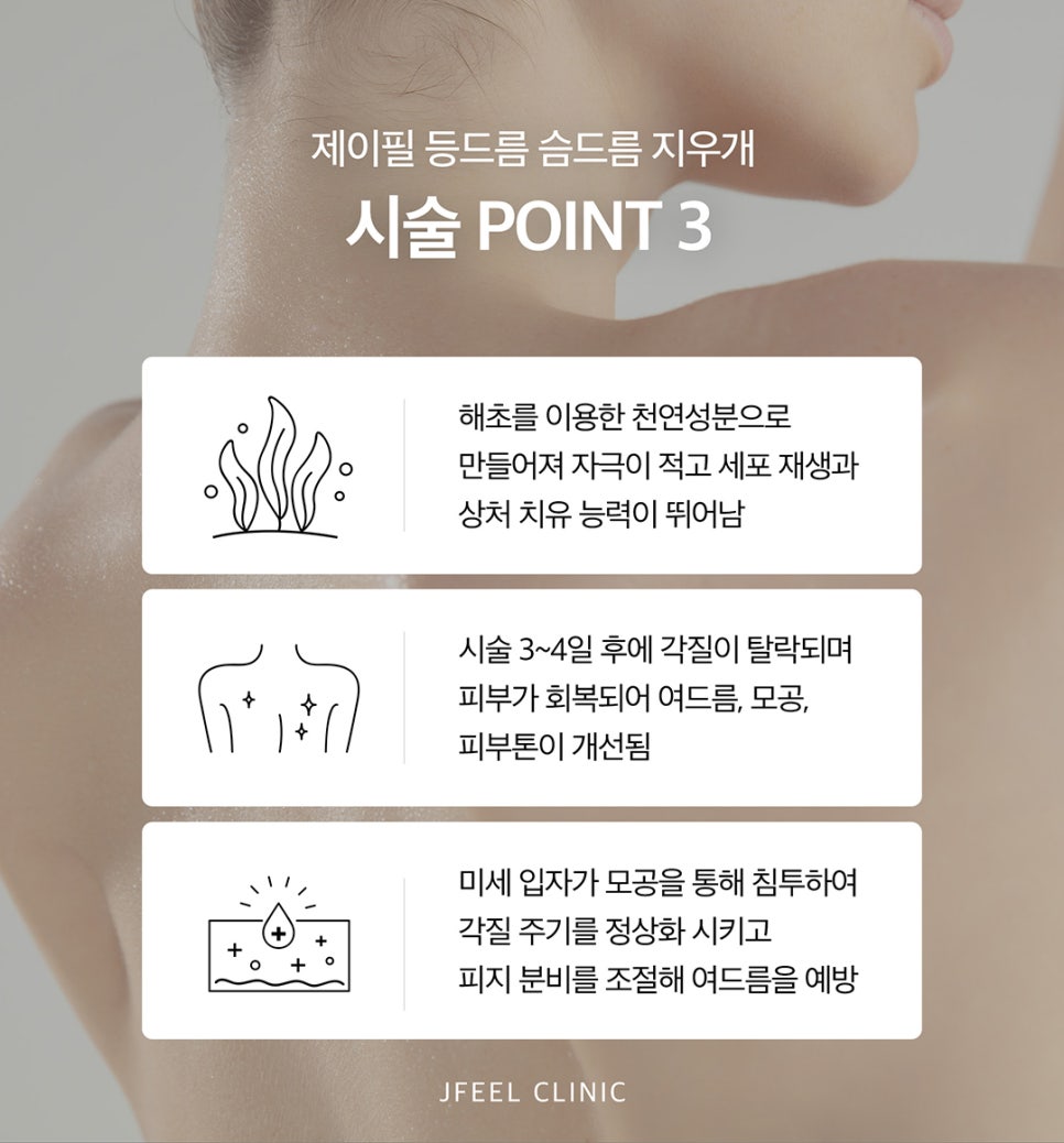 등드름제거는 알리딘필링으로 확실하게! 관련 이미지 5