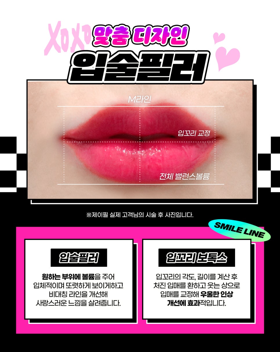 얼굴 동안시술로 자연스럽게 예뻐지고 싶다면? 관련 이미지 4