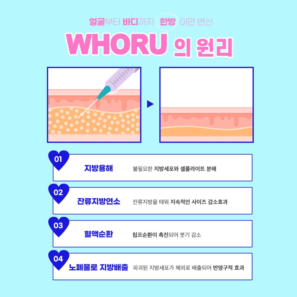 옷이 얇아질수록 뱃살,팔뚝,허벅지 살 때문에 걱정이라면 지방분해  후아유주사 관련 이미지 3