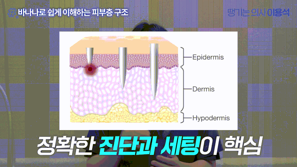 Hongdae Dermatology Pore Care: Why Your Pores Still Look the Same Even After Removing Sebum image 3