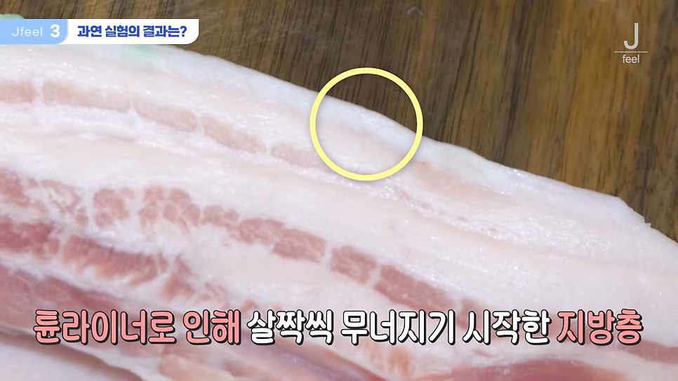 지방레이저가 얼굴 지방을 얼마나 녹일 수 있을까? 관련 이미지 11