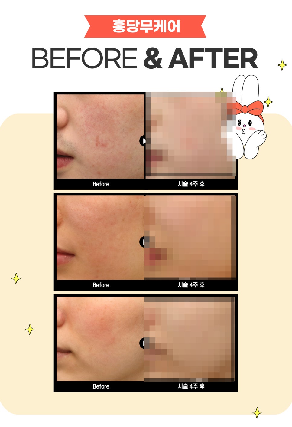 얼굴홍조, 홍당무케어로 화사하게 관련 이미지 7