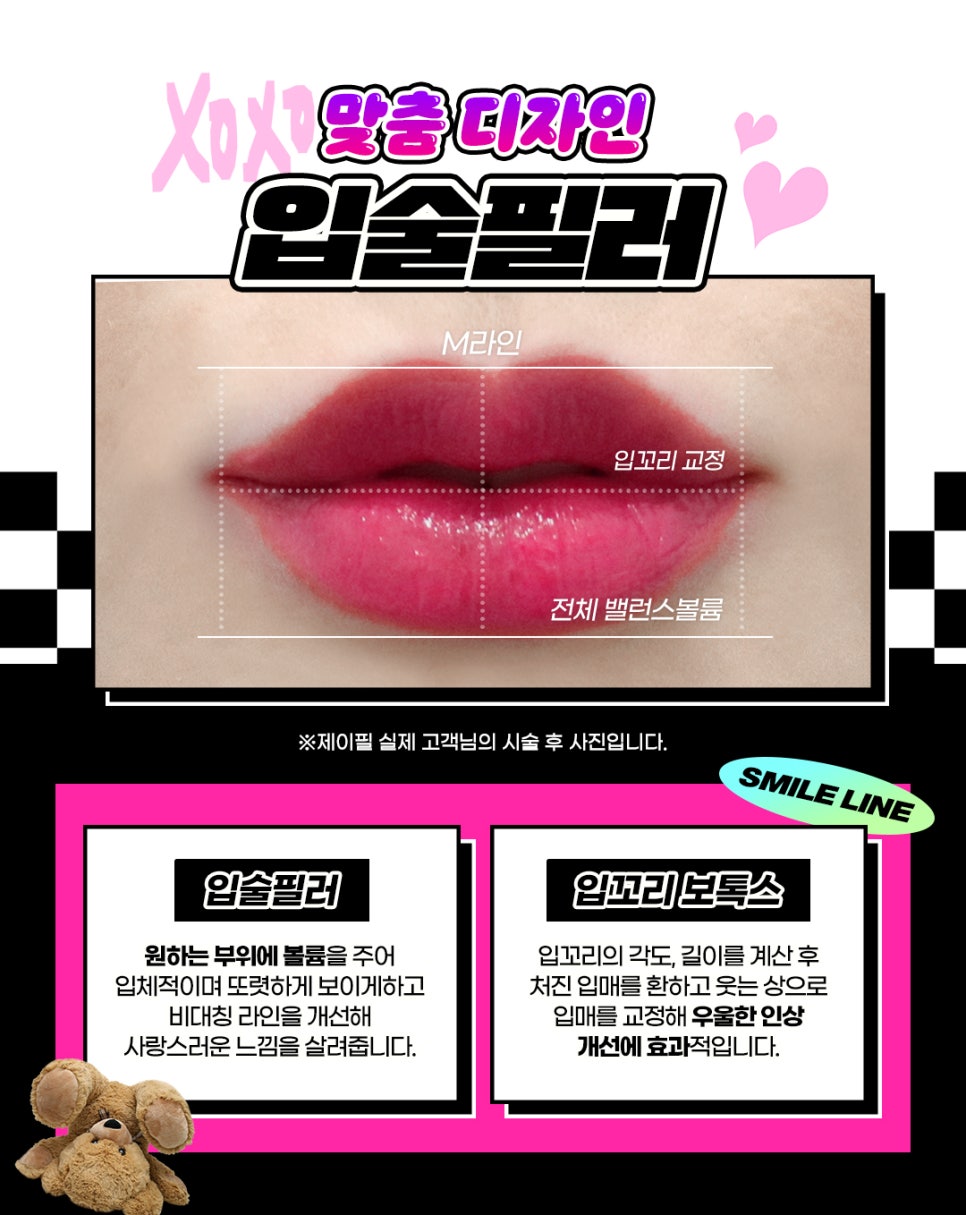 자연스러운 홍대입술필러로 볼륨 UP 매력 UP 관련 이미지 4