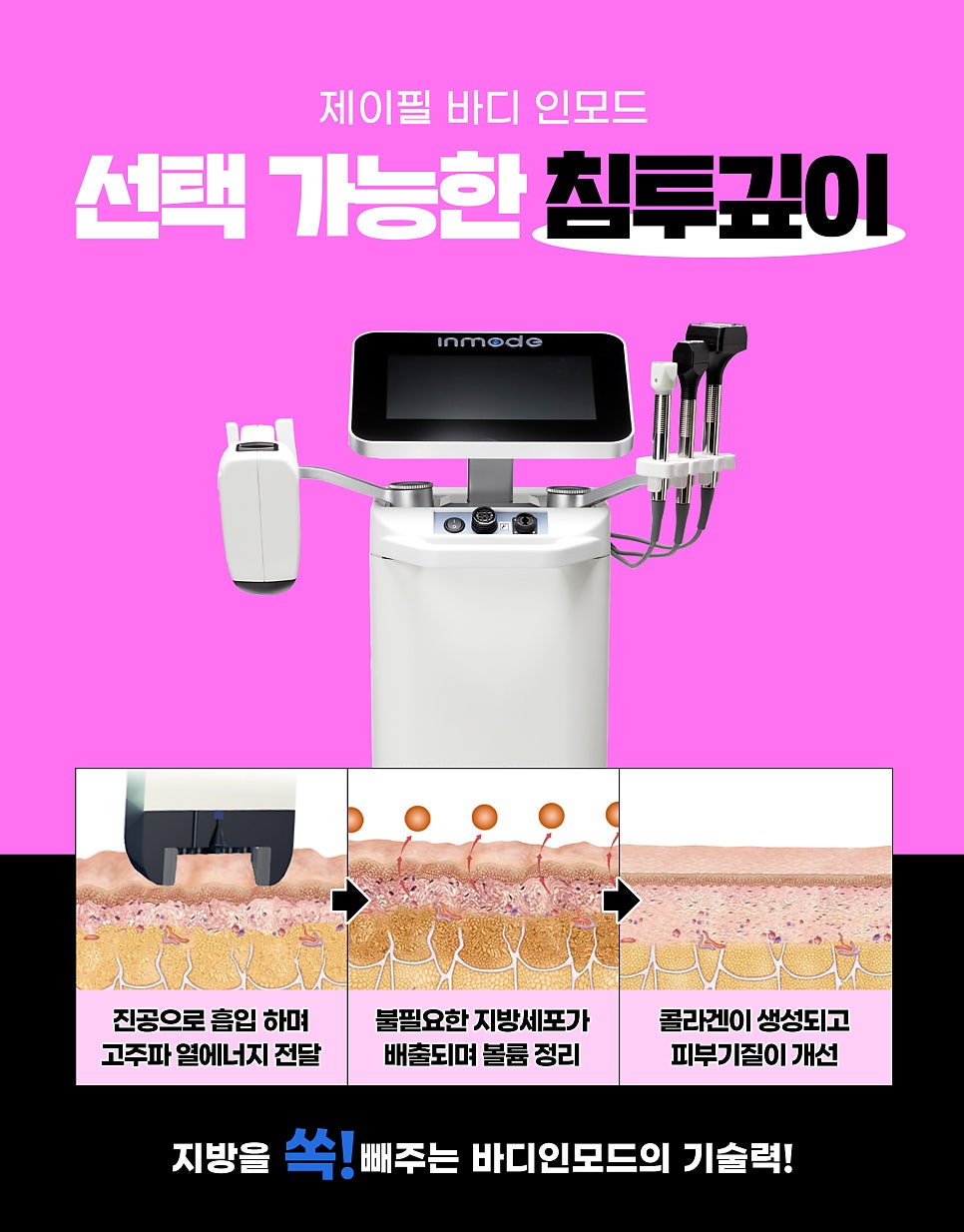 여름철다이어트, 바디인모드와 후아유주사로 끝내자 관련 이미지 3
