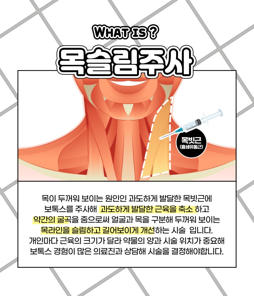직각어깨만들기는 제이필 시그니처 바디보톡스 관련 이미지 3