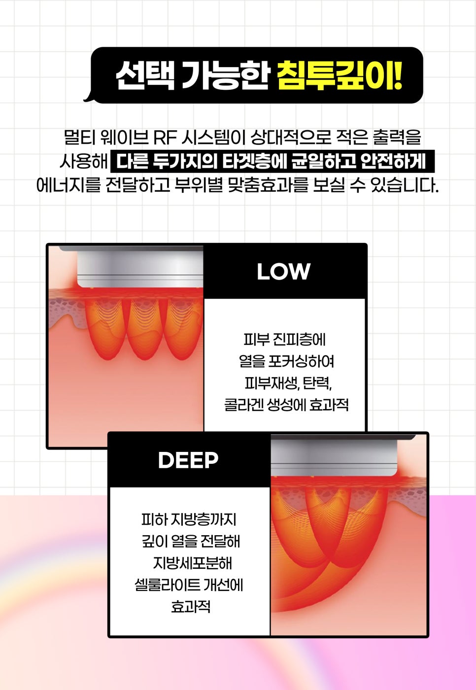 리프팅시술, 부위별로 내 맘대로 관리받기 관련 이미지 4