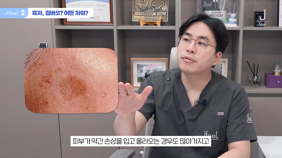 기미 주근깨 잡티에 이 시술만은 NO! 시술 전 필독 관련 이미지 3