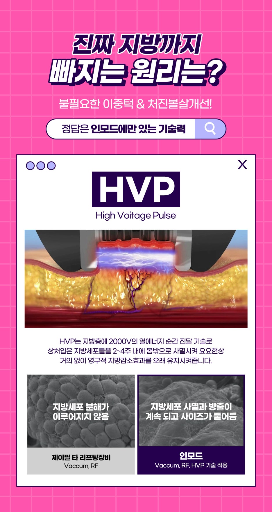 인모드리프팅레이저로 하관집중 케어하기 관련 이미지 6