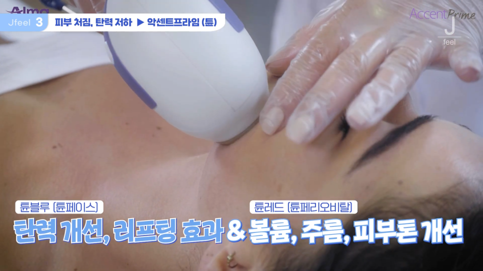 3O대피부과시술 3가지 추천 관련 이미지 9