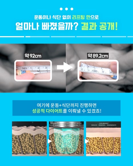 강남 튠페이스 리프팅 │ 온다&middot;소프라노티타늄 비교, 탄력레이저 선택 기준 정리 관련 이미지 10