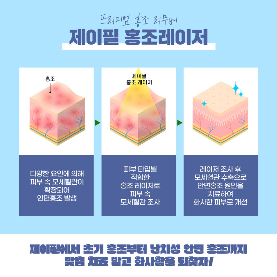홍조피부과에서 발그레한 홍조 없애고 만족 관련 이미지 4