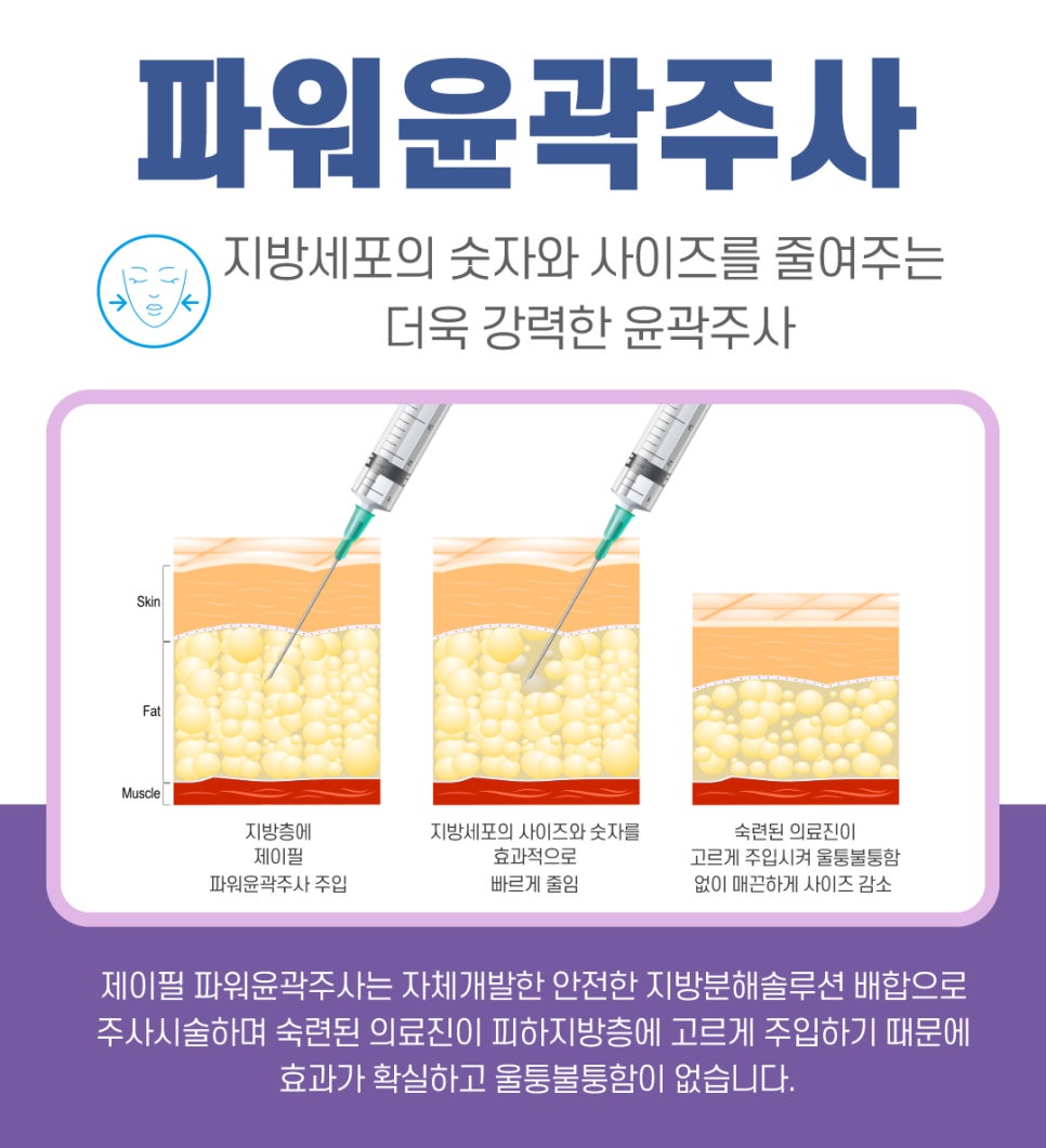 [홍대피부과] 진정한 V라인은  슈링크+제이필 파워윤곽주사 로 완성 관련 이미지 3