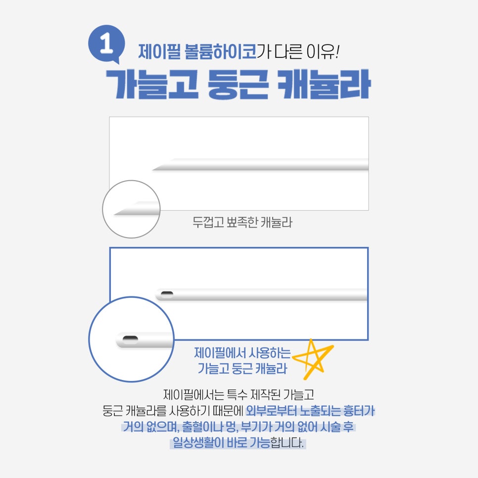 4월추천시술! 슈퍼 하이코, 코필러로 쉽고 간단하게 예뻐지는법 관련 이미지 2