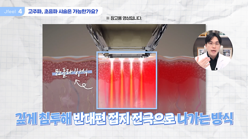 임산부피부과 시술 가능한가요? Q&A 관련 이미지 16