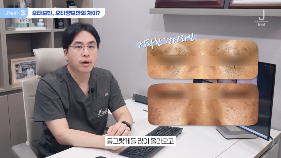 기미 주근깨 잡티에 이 시술만은 NO! 시술 전 필독 관련 이미지 7