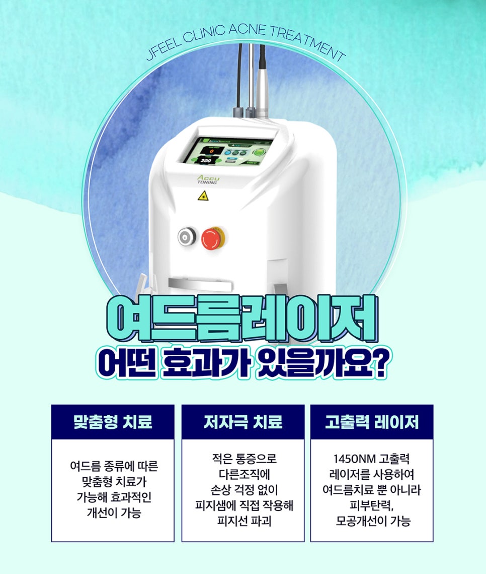 피지억제 레이저로 기름진 얼굴 여드름 STOP 관련 이미지 4