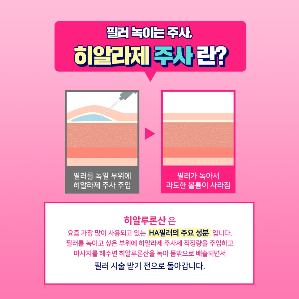 얼굴 동안시술로 자연스럽게 예뻐지고 싶다면? 관련 이미지 8