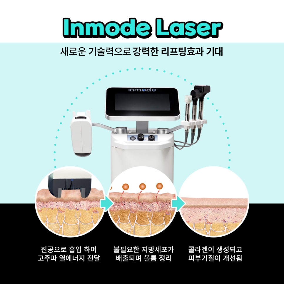 슈링크+인모드 리프팅 효과 제대로보고 이벤트 받는 법 관련 이미지 3