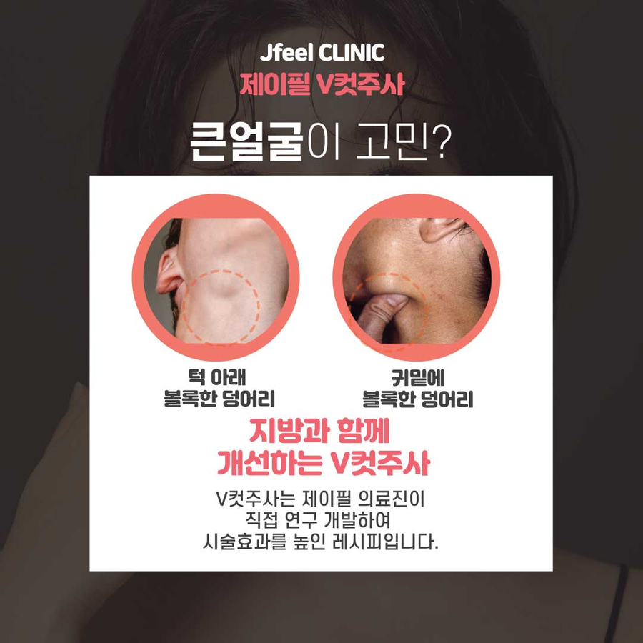 보톡스를 이용한 안면 주름개선과 발달된 근육 축소 시술 관련 이미지 7