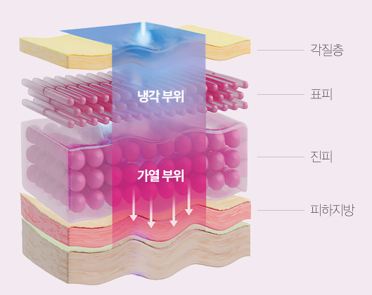 30대 40대 피부관리 추천|고우리·써마지·줄기세포 시술 TOP3 관련 이미지 10