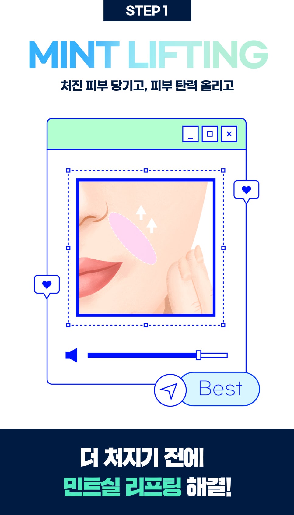 팔자주름리프팅, 비수술로 팽팽하게 채우기 관련 이미지 4
