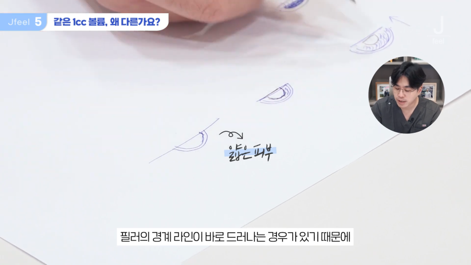 필러시술, 좋은 필러를 고르는 3가지 기준 관련 이미지 18