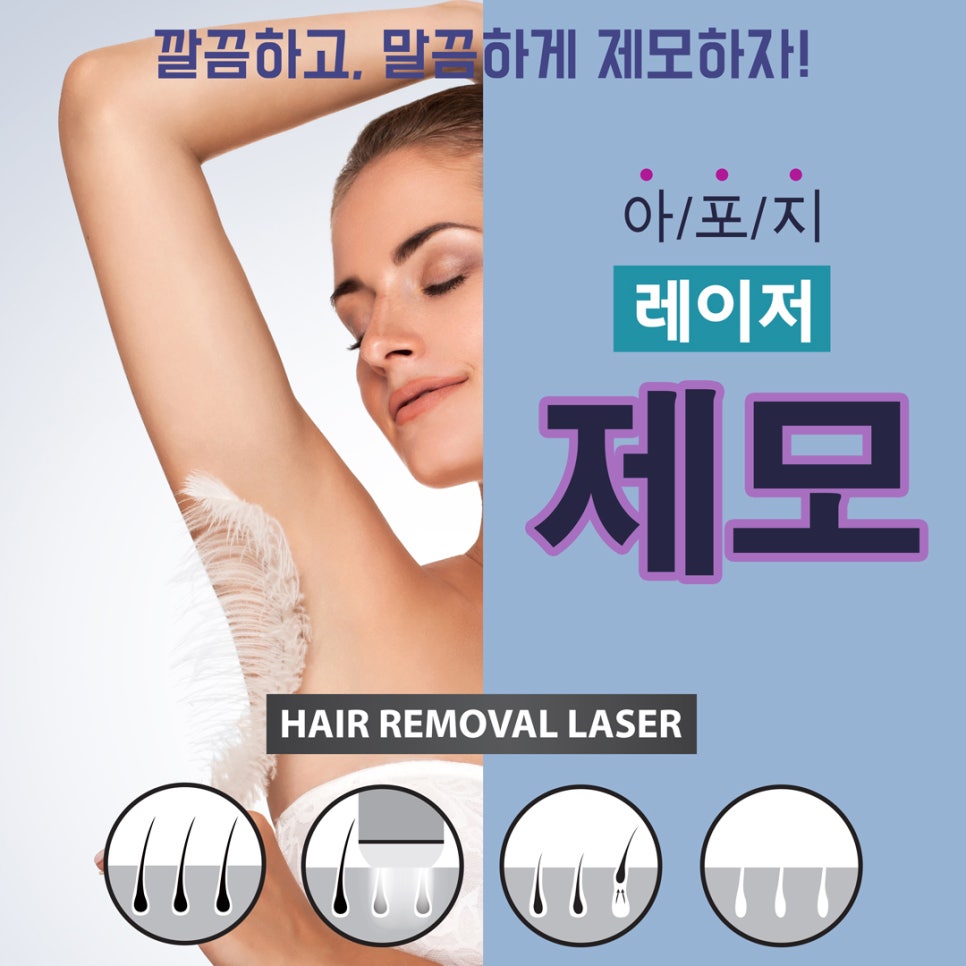 [홍대피부과] 여름 준비 시작은 제모. 홍대 아포지 레이저 제모 관련 이미지 1