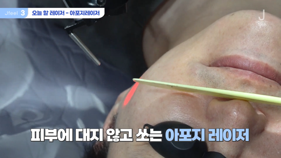 수염 레이저 제모 원장님 직접 리뷰 관련 이미지 8