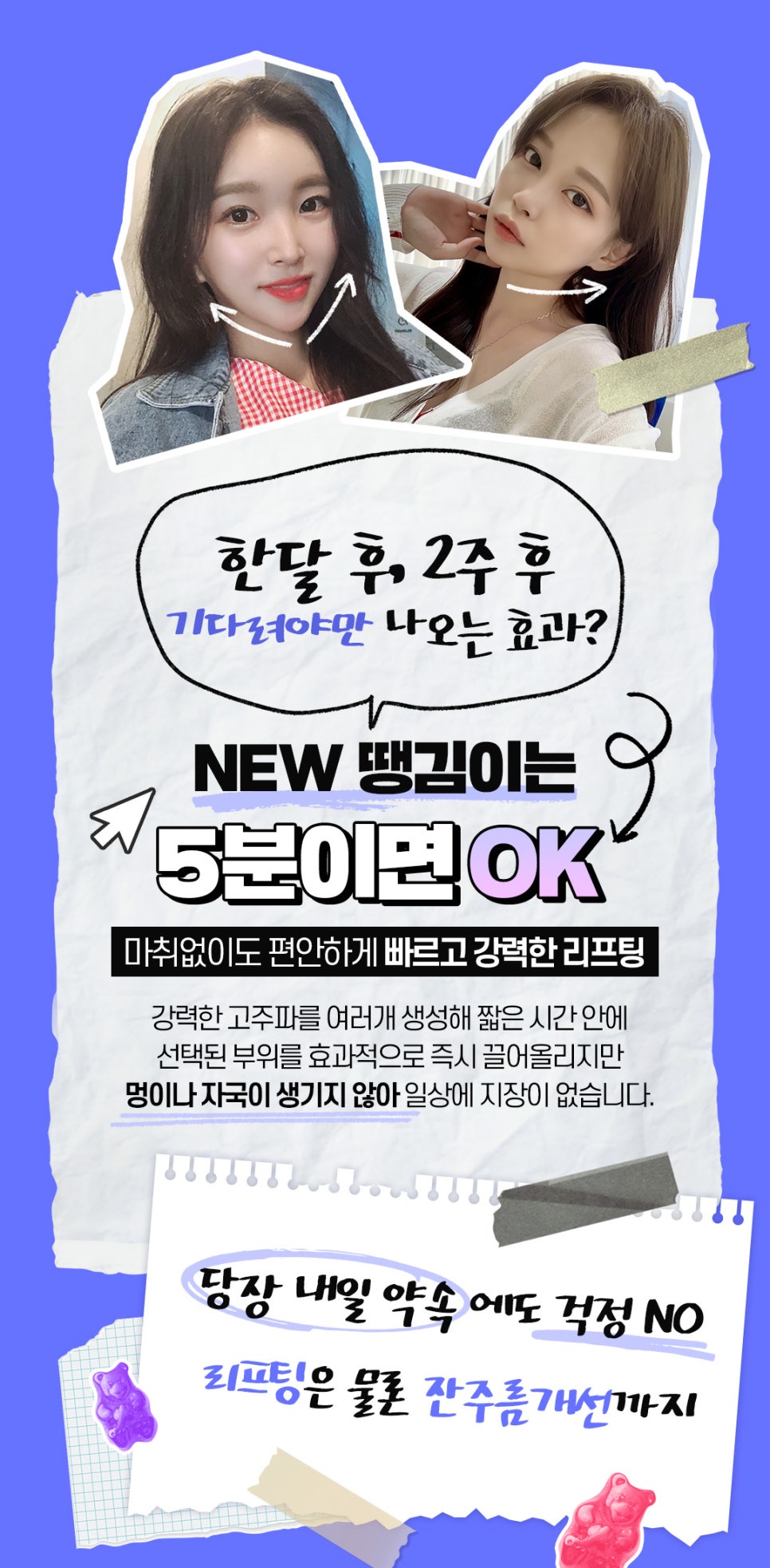 이중턱제거 땡김이, 인모드보다 빠르게 나타나는 효과 관련 이미지 3