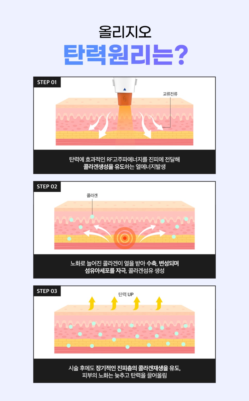 레이저리프팅 중년필수템 올리지오+울쎄라 할인받자 관련 이미지 4