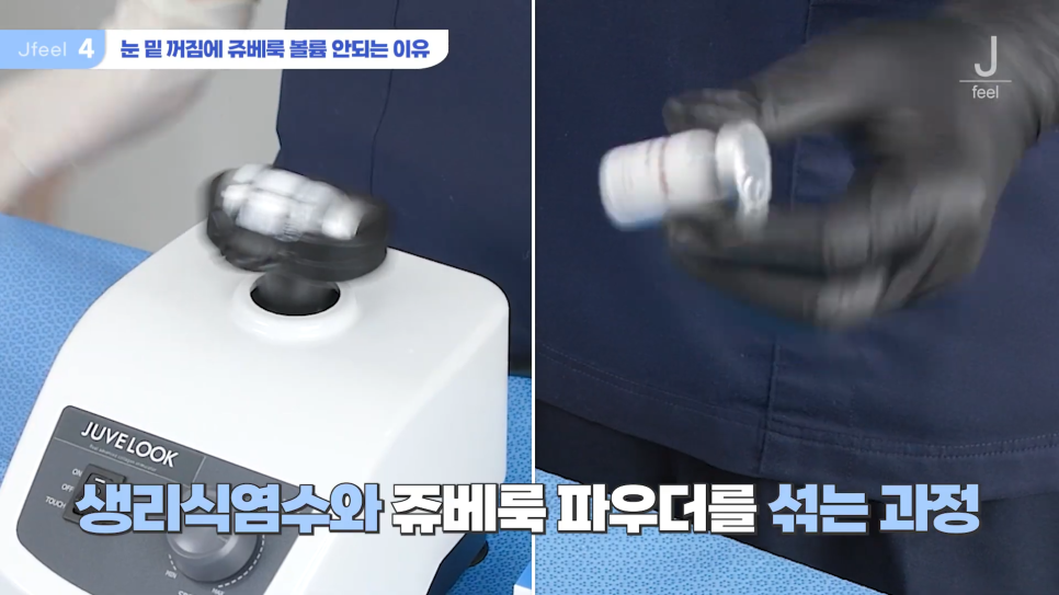 눈밑꺼짐에 들어가는 쥬베룩의 함정 관련 이미지 5