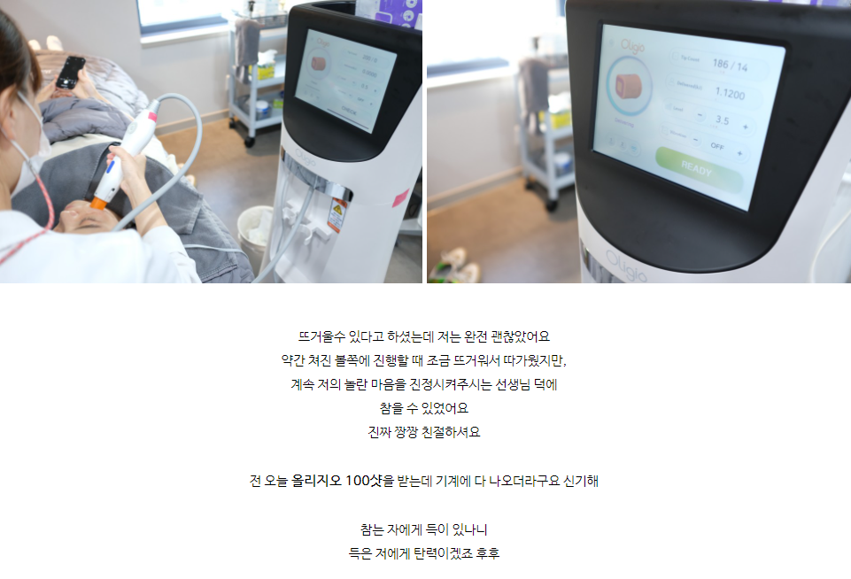 홍대 올리지오 리프팅 리얼 효과,후기 궁금하신가요? 관련 이미지 3