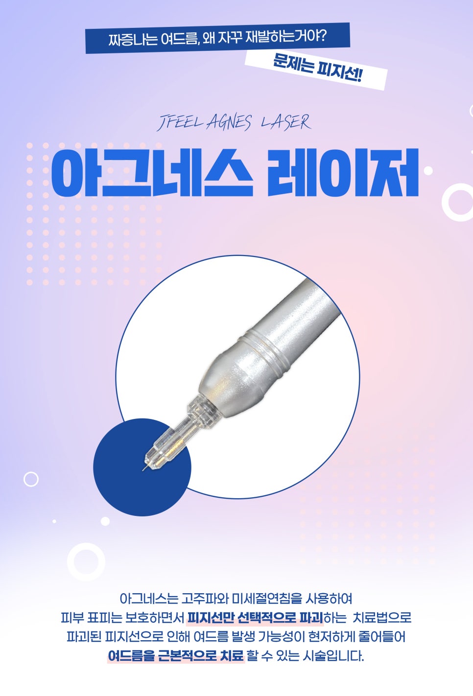 블랙헤드관리, 모공 속 피지 관리가 우선 관련 이미지 6
