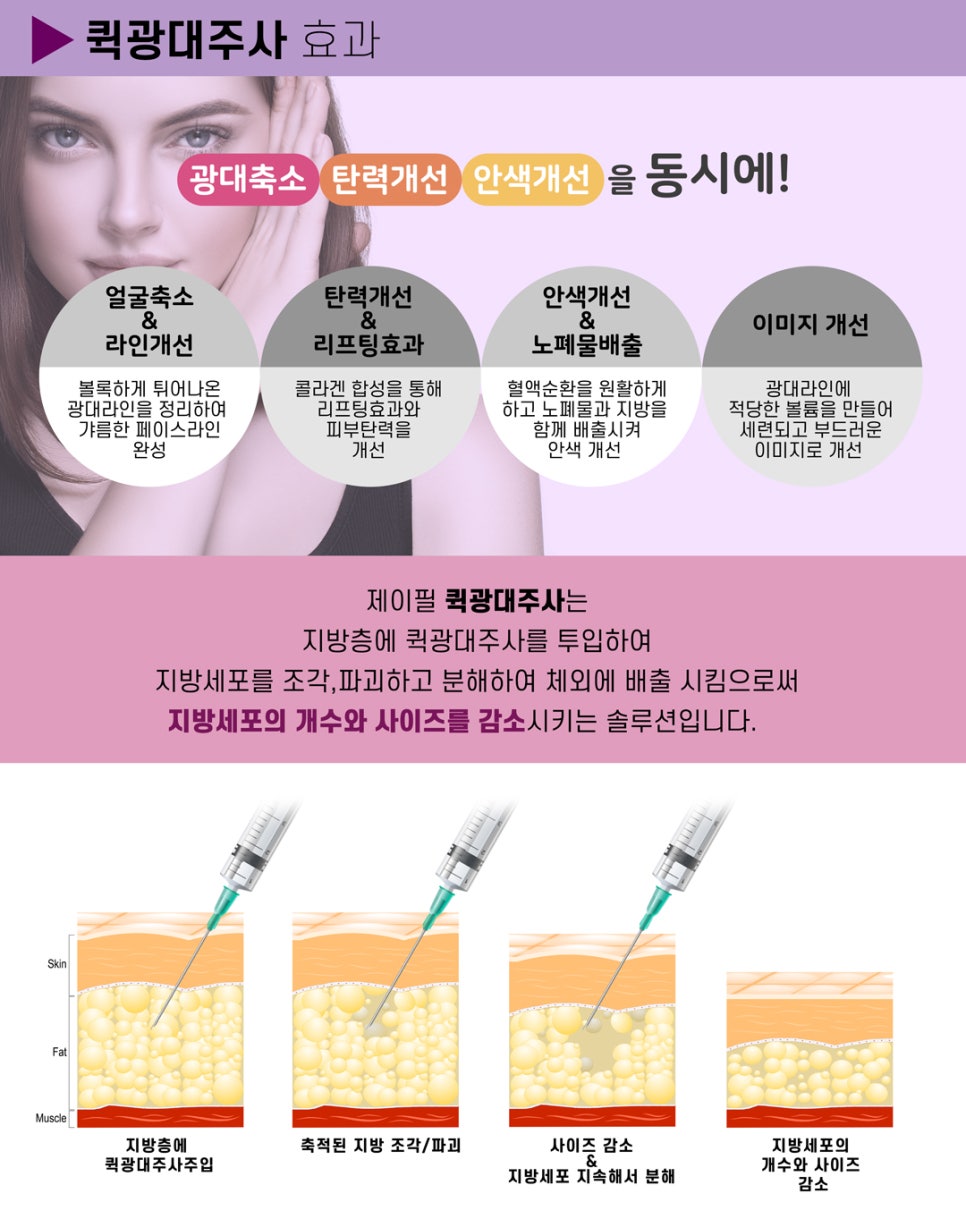 [홍대피부과] 수술없이 광대축소  "퀵광대주사" 관련 이미지 4