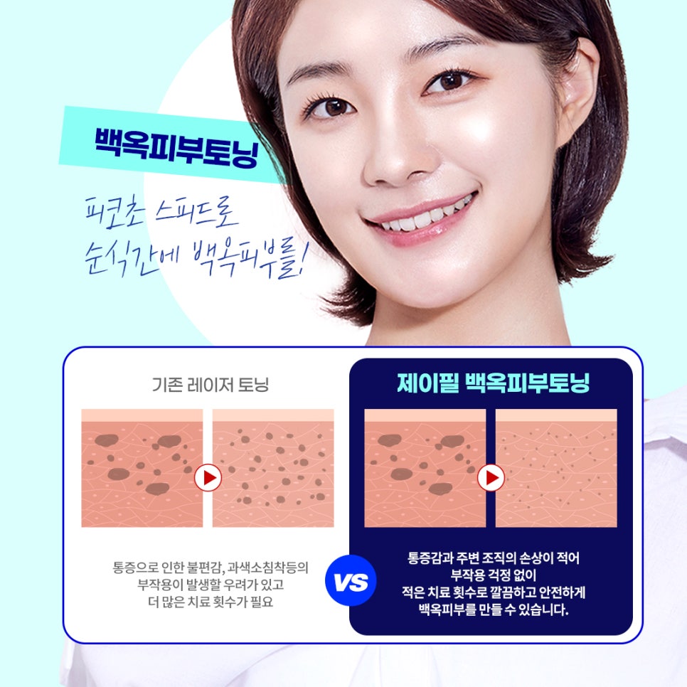 기미색소잡티 고민? 백옥피부토닝으로 완벽커버 관련 이미지 2