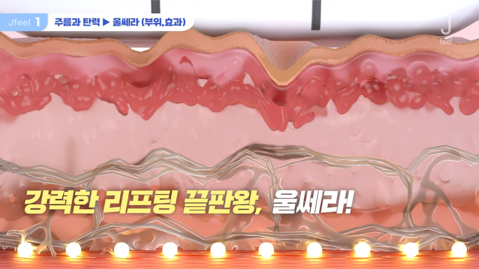 3O대피부과시술 3가지 추천 관련 이미지 2