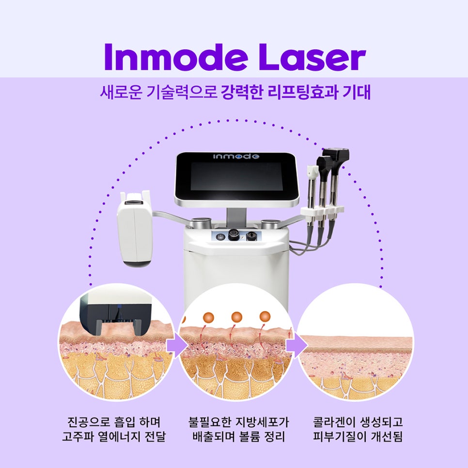 브이슈링크 + 인모드 조합으로 이중턱 없애는 방법 알려드려요 관련 이미지 3